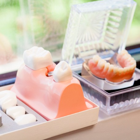 Tooth Extractions, Richmond Hill & Toronto Oral Surgeon